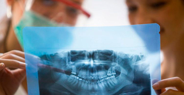 Ортопантомограмма зубов, что это такое?